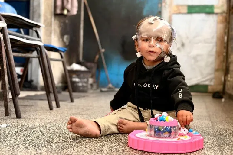 طفل مصاب بجروح في وجهه، يرتدي قناع ضغط طبي، يجلس على الأرض بجوار لعبة ملونة، في بيئة بسيطة تعكس معاناة الأطفال في غزة.