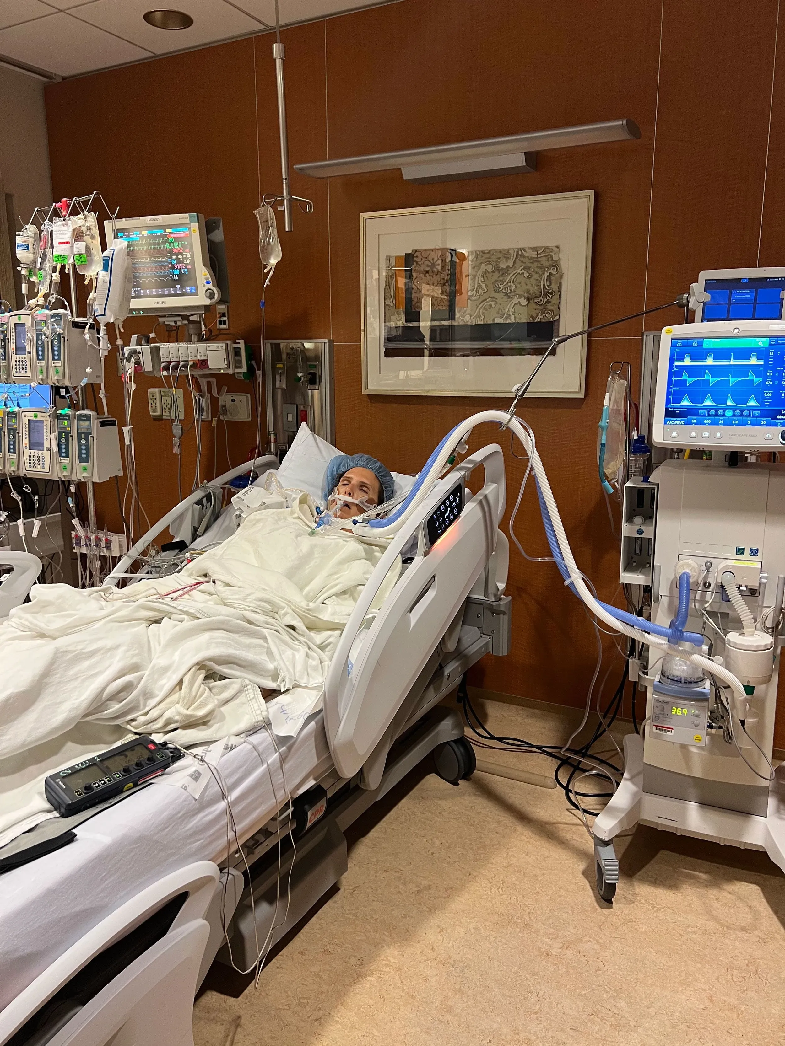 سمر مكيسون مستلقية على سرير في المستشفى، محاطة بأجهزة طبية، تعاني من آثار عملية جراحية قلبية، تعبيرات وجهها تظهر القلق.