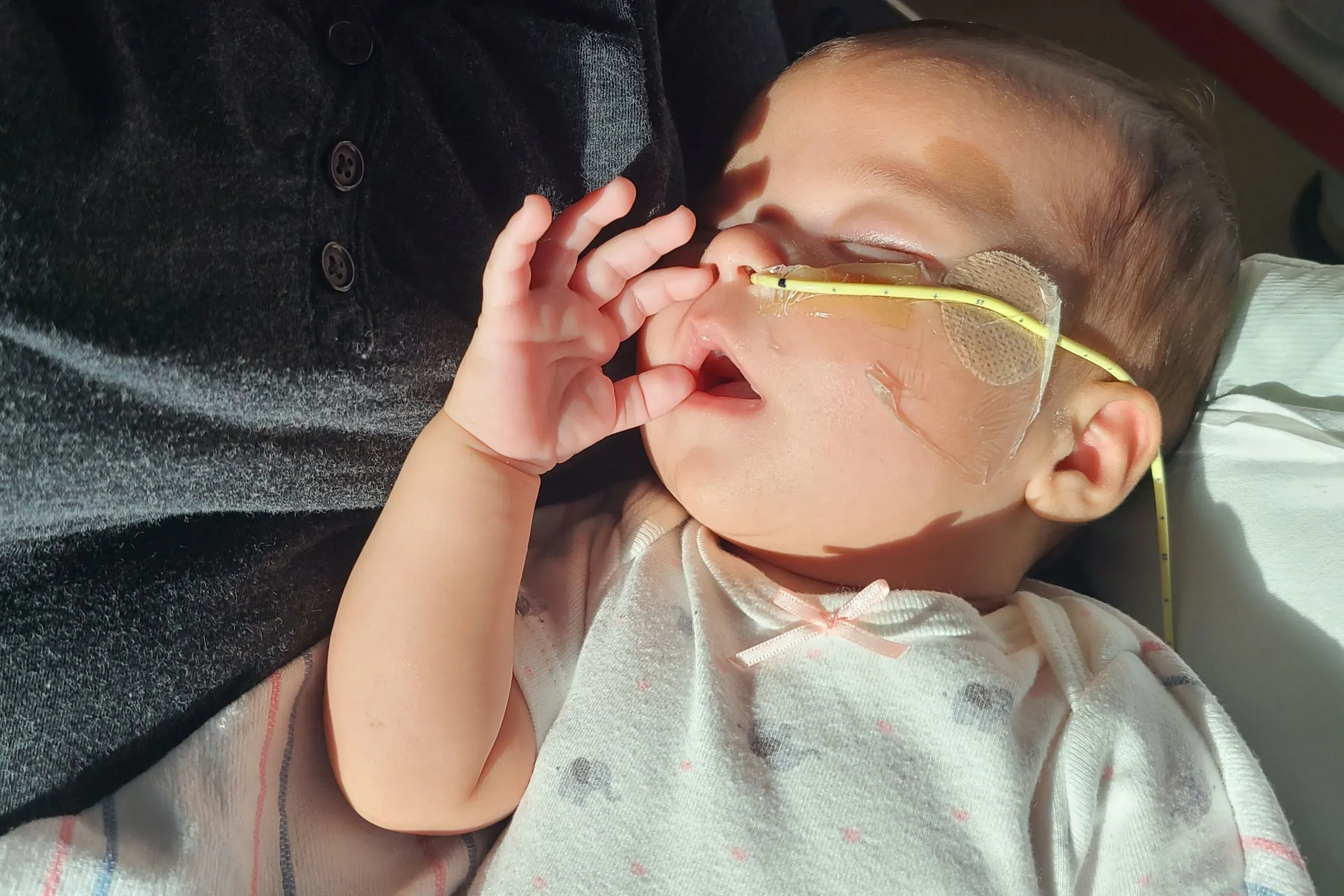 رضيعة نائمة في المستشفى، ترتدي قميصًا أبيض وتستخدم أنبوب أكسجين، تعاني من أعراض تسمم غذائي بسبب حليب الأطفال الملوث.