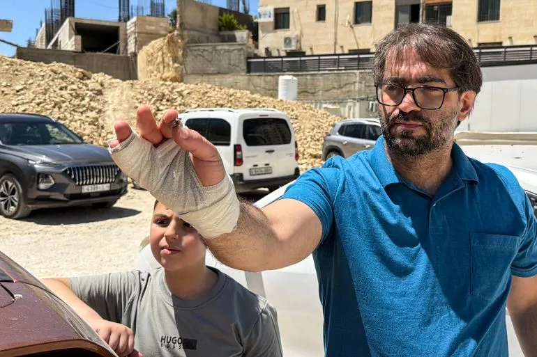 فهد أبو هيكل، مصاب برصاصة في يده، يقف مع ابنه كنان في منطقة الخليل، حيث وقعت حادثة إطلاق النار التي أودت بحياة ابنه الرضيع.