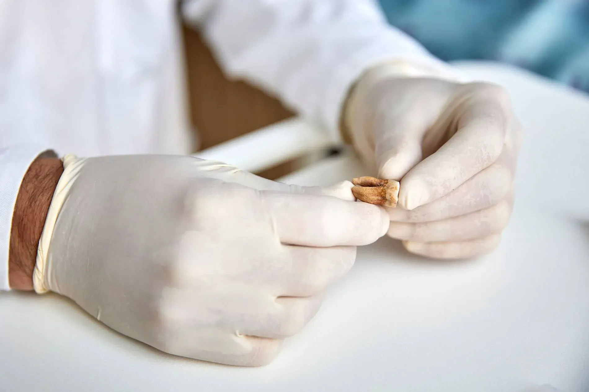 عالم آثار يحمل سنًا قديمًا، بينما يرتدي قفازات، في سياق دراسة مسببات الأمراض المرتبطة بجيش نابليون.