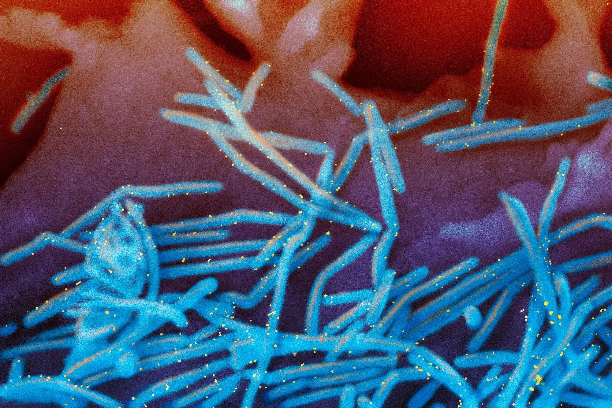 صورة مجهرية تظهر فيروس الالتهاب التنفسي المخلوي التنفسي (RSV) بألوان زاهية، مما يعكس انتشاره المتزايد وتأثيره على صحة الأطفال.