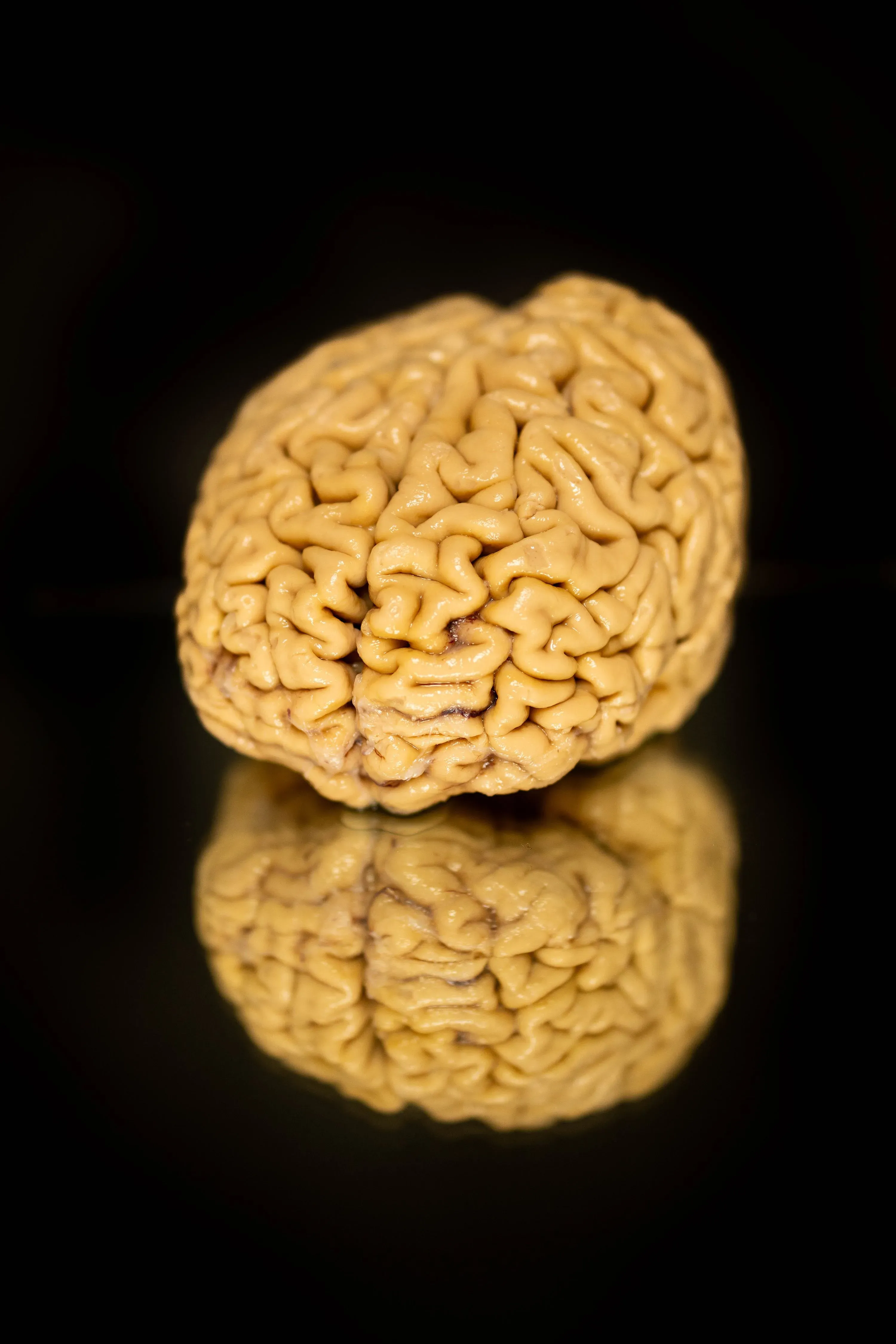 صورة لدماغ بشري يظهر تفاصيله الدقيقة على خلفية داكنة، مما يعكس أهمية البحث في الخلايا العصبية ودورها في صحة الدماغ لدى كبار السن.