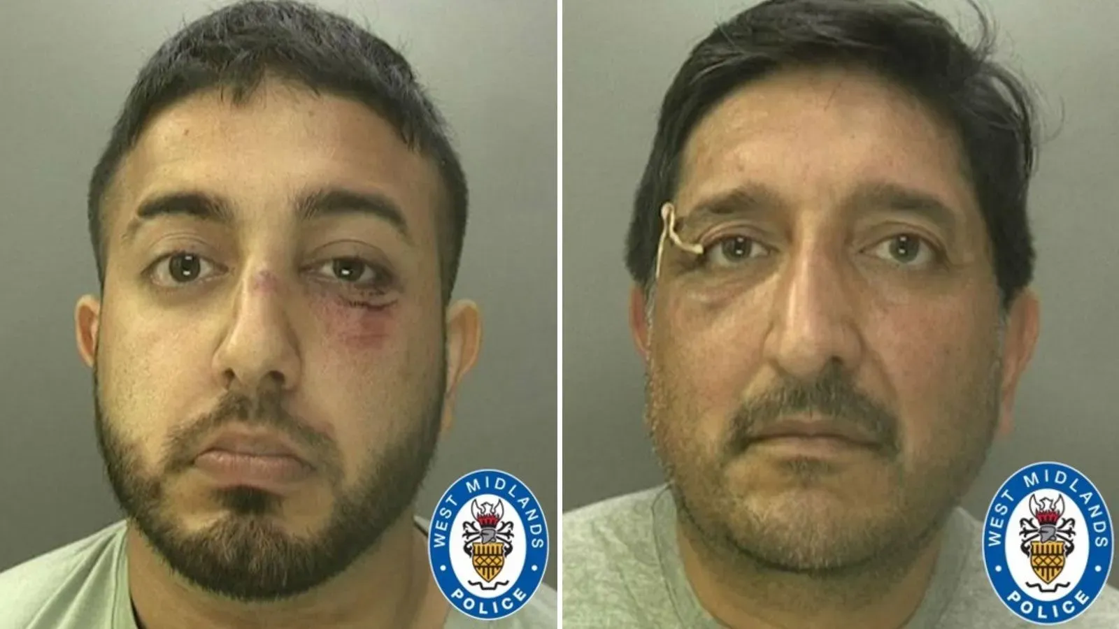 صورة لاثنين من الرجال، أحدهما مصاب بكدمات حول عينه، والآخر يحمل جهازًا طبيًا على وجهه، مع شعار شرطة ويست ميدلاندز.