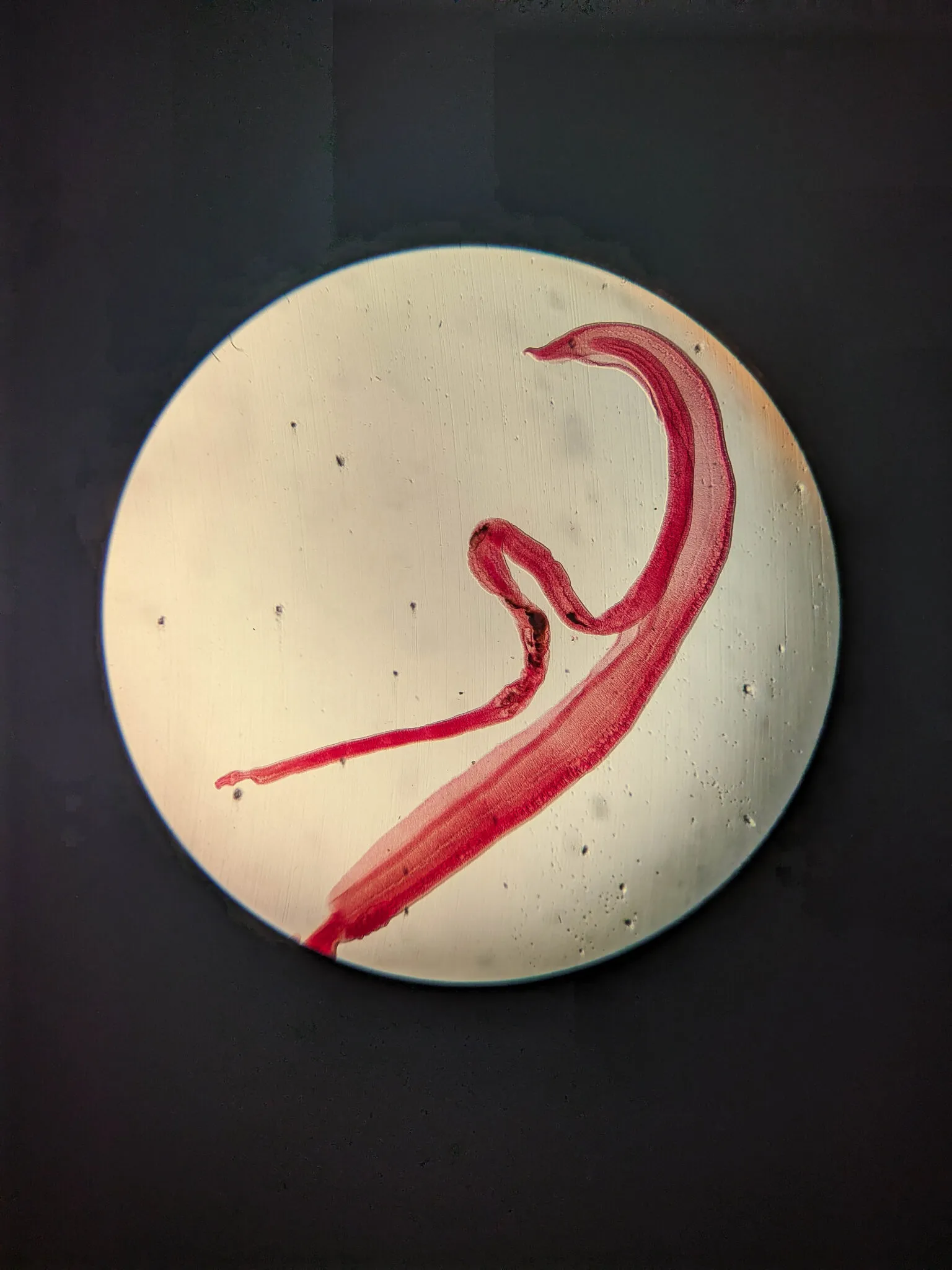 دودة طفيلية من جنس Schistosoma تظهر تحت المجهر، مرتبطة بداء البلهارسيا الدماغي وتأثيرها على الجهاز العصبي المركزي.
